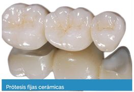 QF Laboratorio Dental protesis